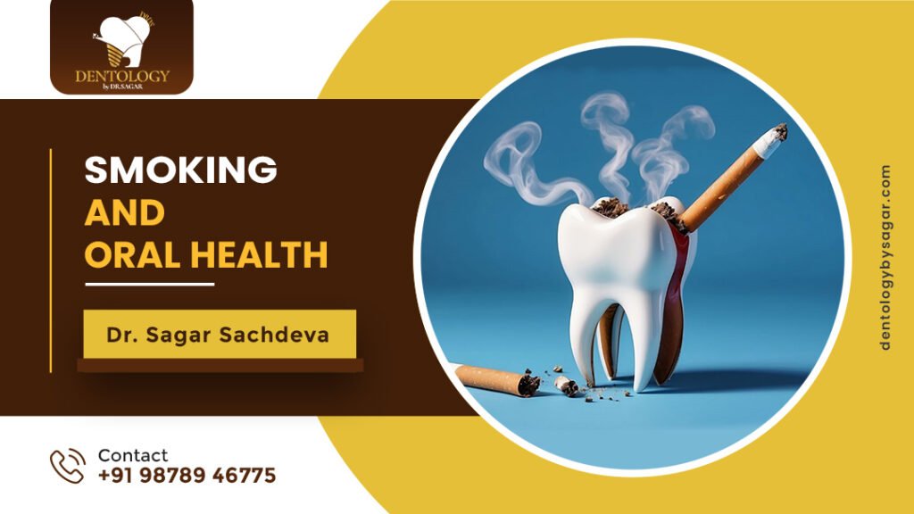 smoking and oral health