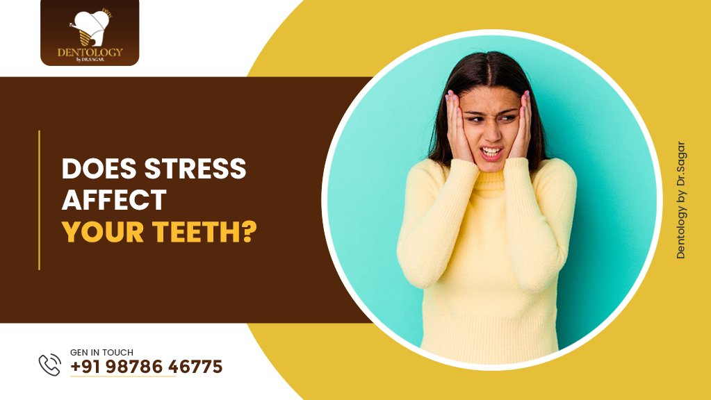 Does Stress Affect Your Teeth