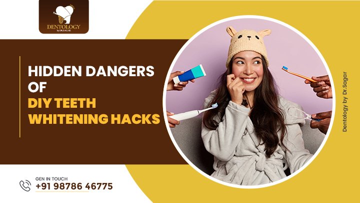 Hidden Dangers of DIY Teeth Whitening
