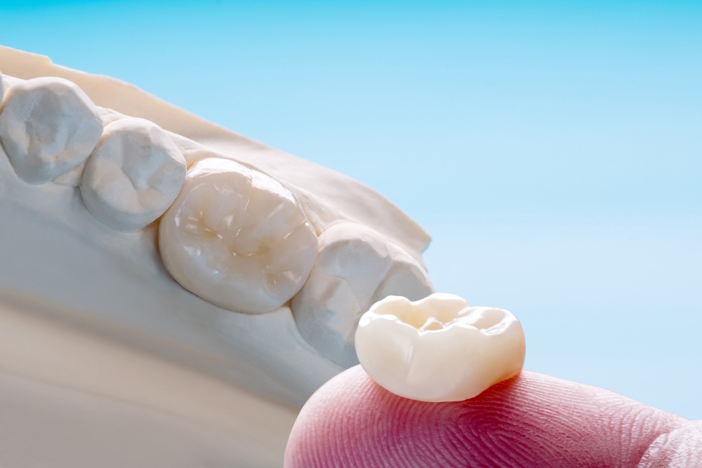 What Are Crowns?