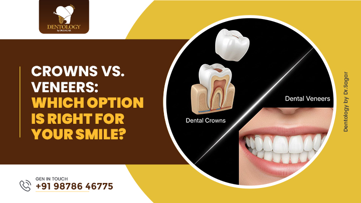 Which Option Is Right for Your Smile