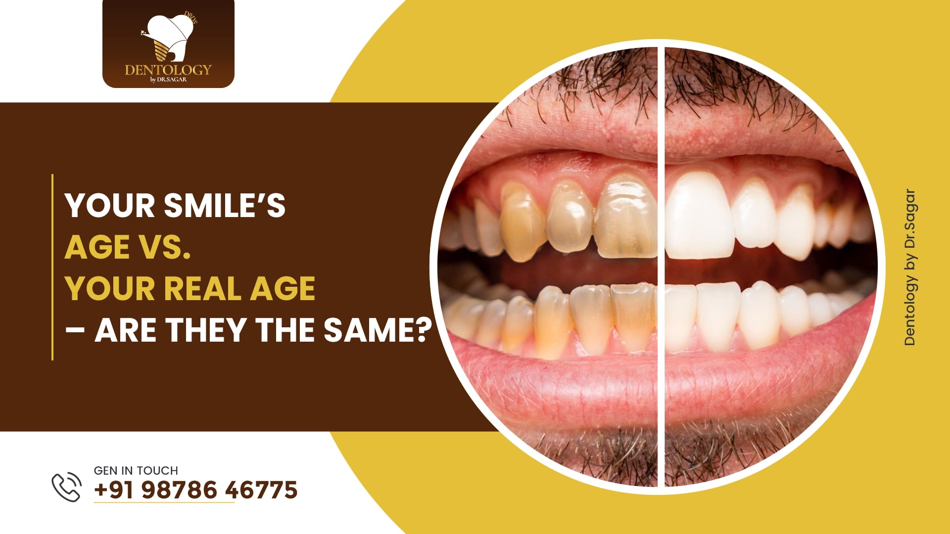 Does your smile make you look older? Learn how to restore a youthful, bright smile with cosmetic and restorative treatments at Dentology by Dr. Sagar, Ludhiana.