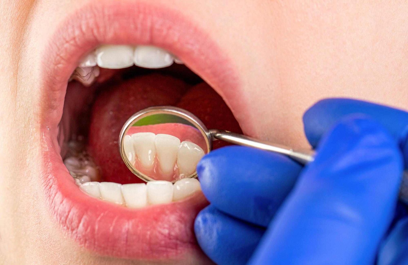 Gum Health Is a Silent Indicator