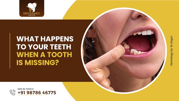 What Happens to Your Teeth When a Tooth Is Missing?