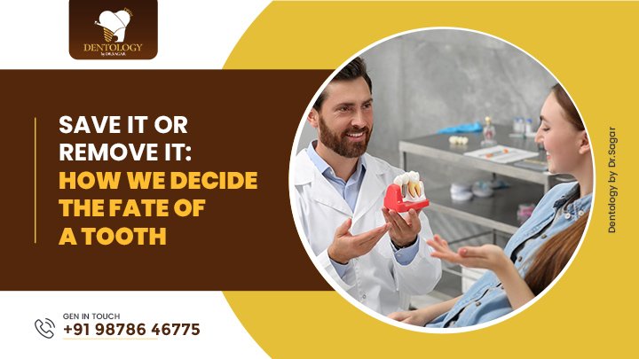 Save It or Remove It: How Dentists Decide a Tooth’s Fate