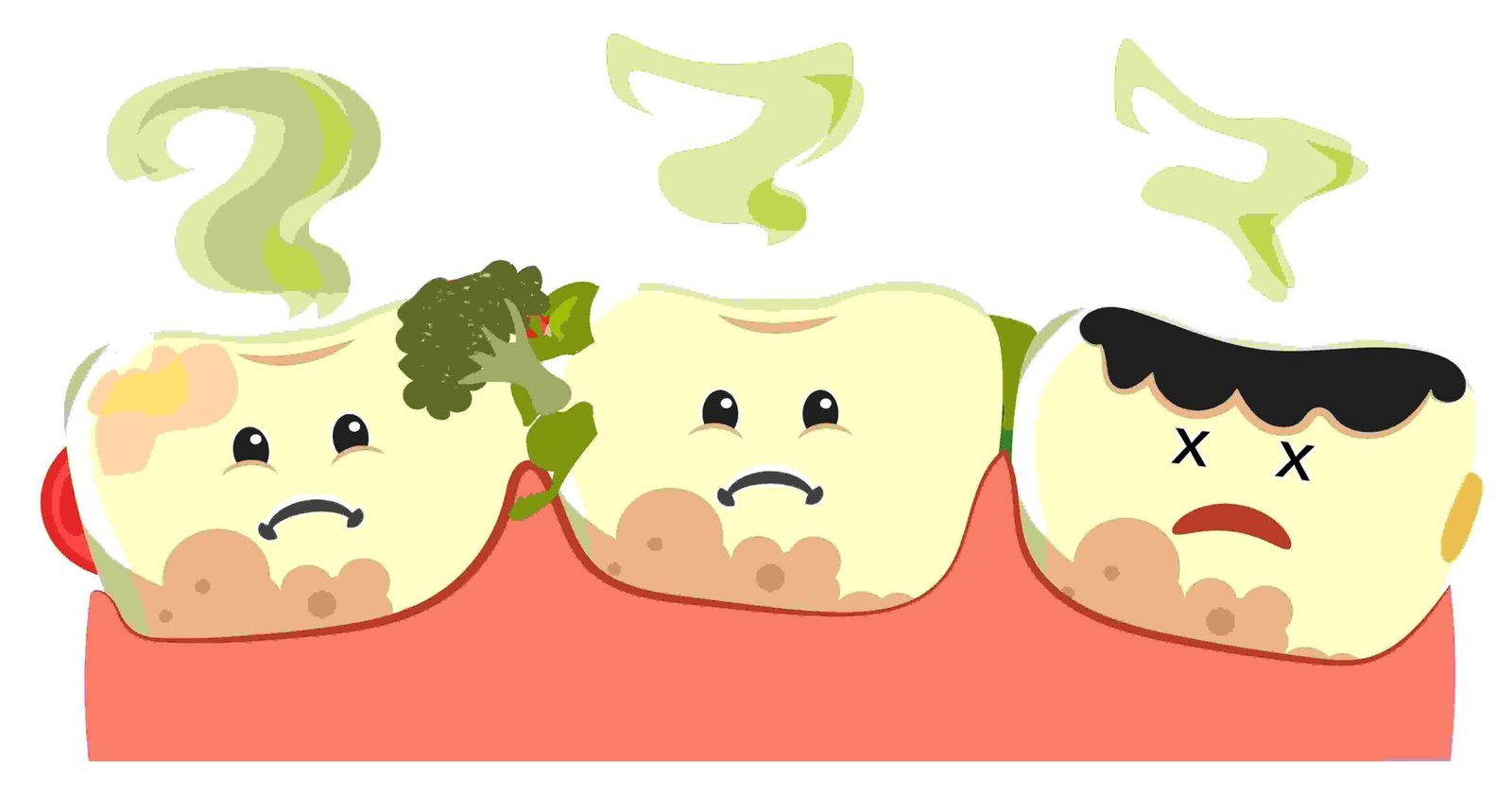 Why You Should Not Ignore Food Trapping