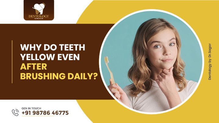 Why teeth yellow after brushing