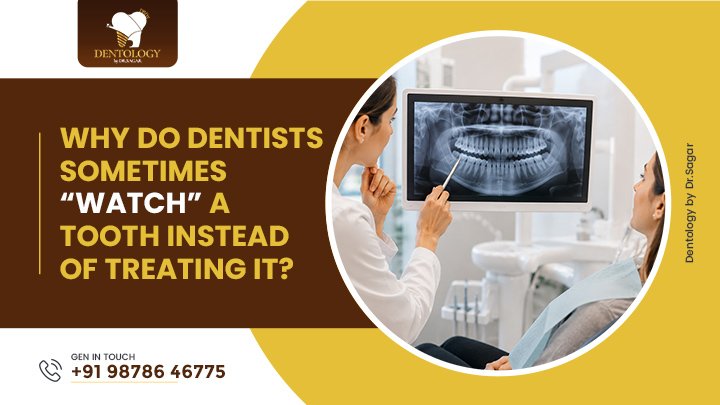 Why Do Dentists Sometimes “Watch” a Tooth Instead of Treating It?