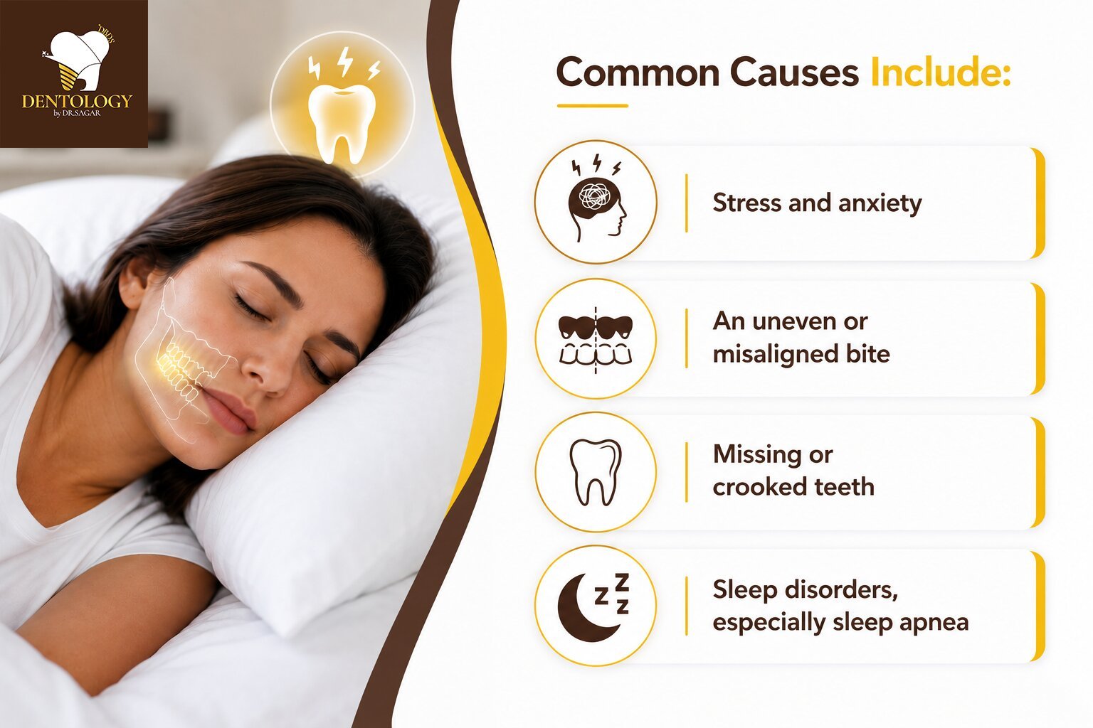 What Is Bruxism, and Why Does It Happen?