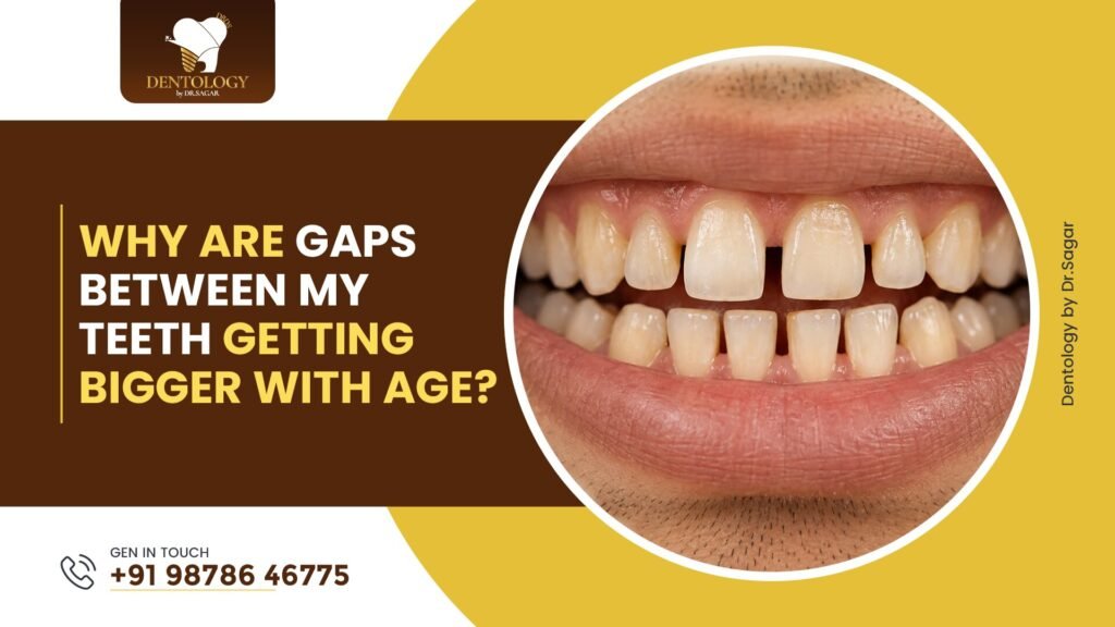 Why Are Gaps Between My Teeth Getting Bigger With Age