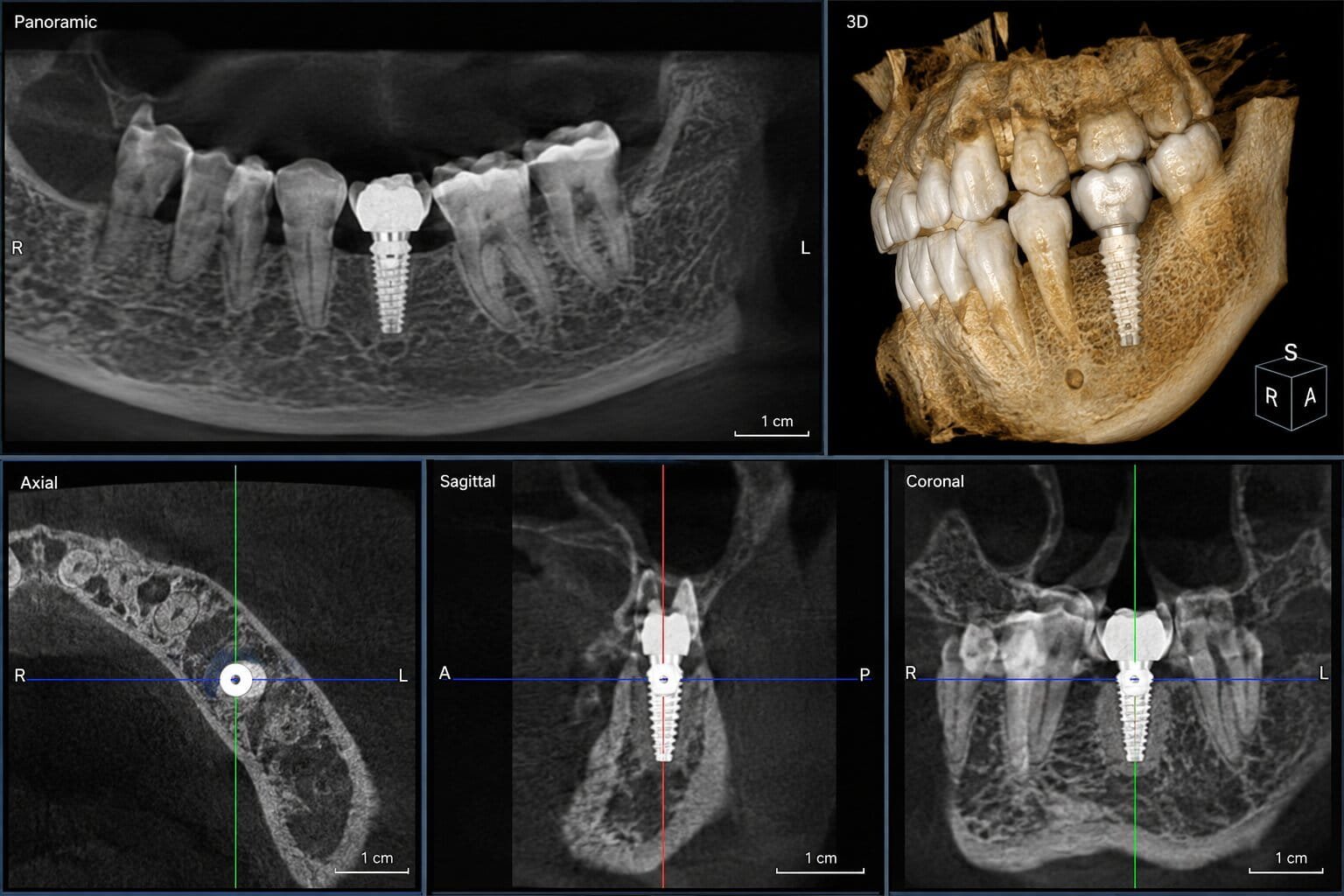 Initial Consultation and Examination