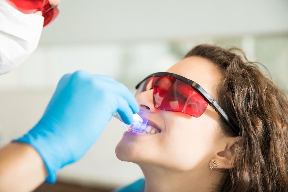 Internal Tooth Bleaching