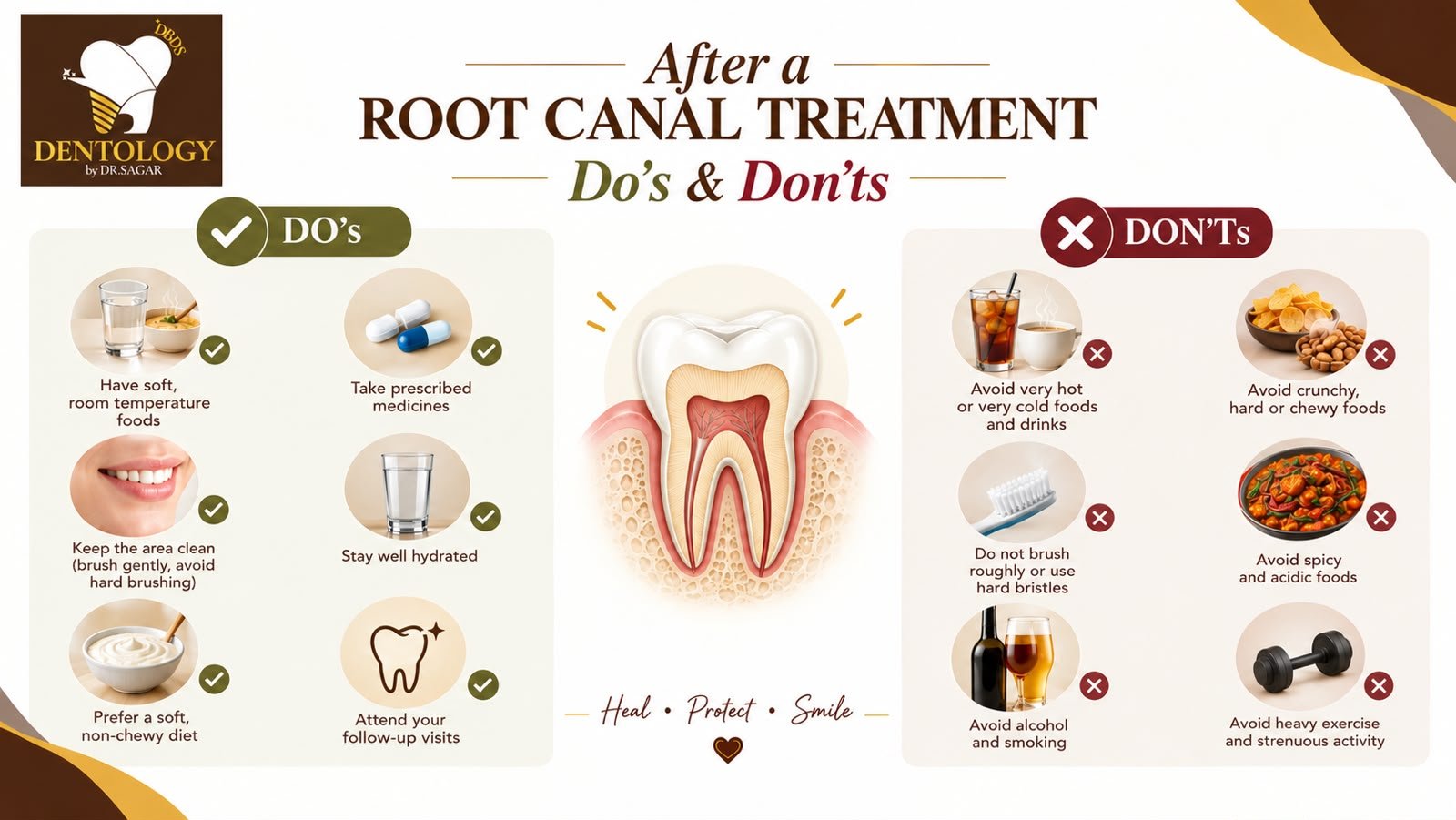 What Should You Do After a Root Canal